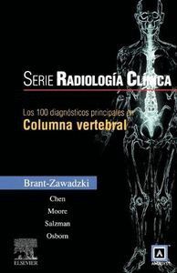 LOS 100 DIAGNSTICOS PRINCIPALES EN COLUMNA VERTEBRAL