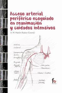 ACCESO ARTERIAL PERIFERICO ECOGUIADO EN REANIMACION Y CUIDADOS INTENSIVOS